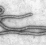 ebola virus disease