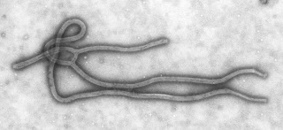 ebola virus disease