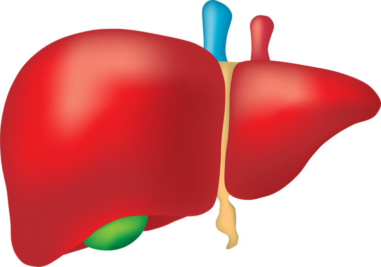 Liver, Fatty liver disease